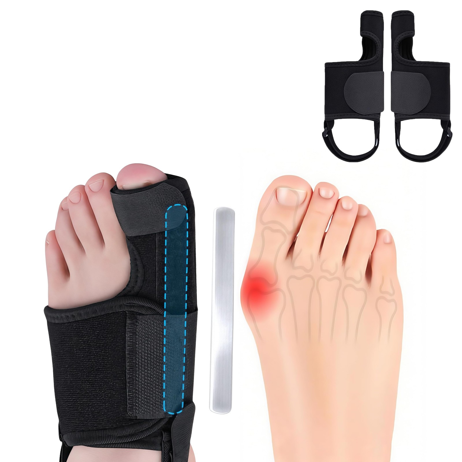Recovist Bunion Brace for Women & Men – Corrector & Big Toe…