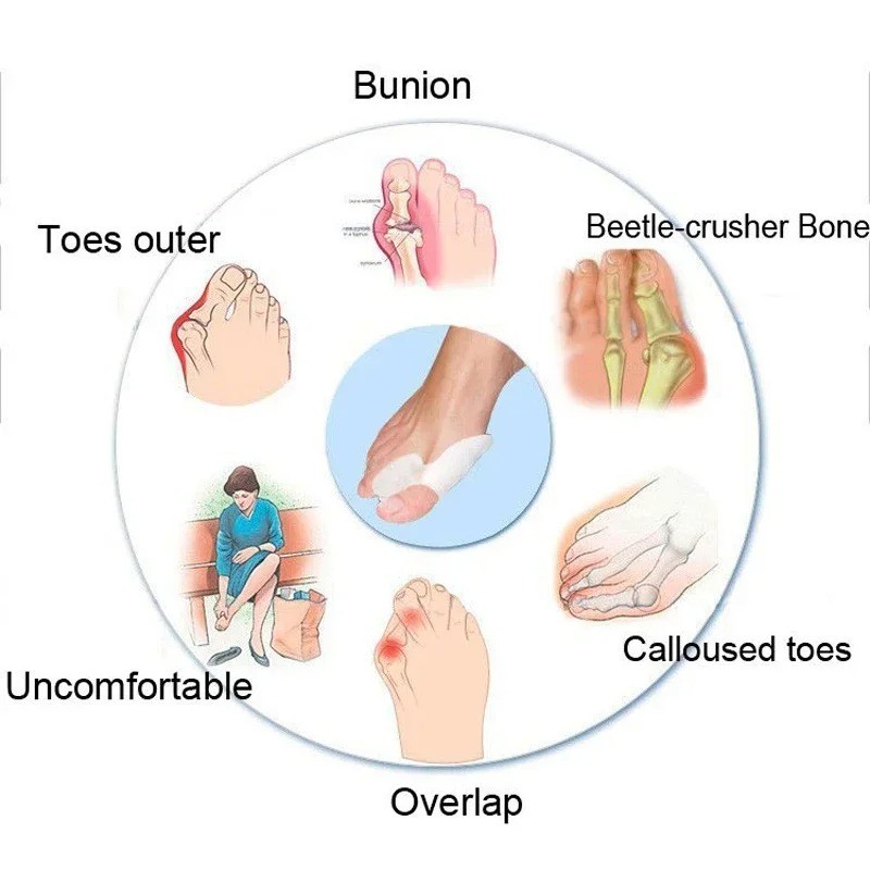 Silicone Gel Toe Separator & Bunion Corrector – Little Toe Protector Thumb Valgu