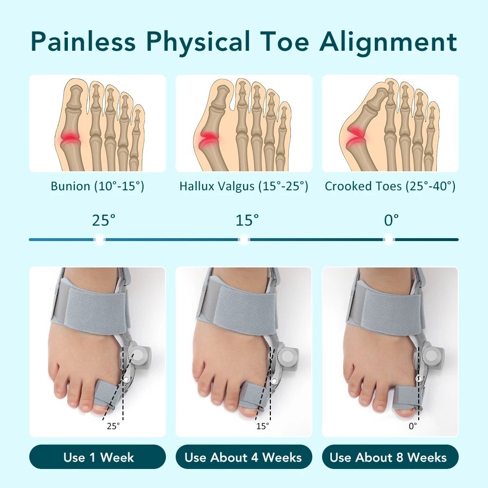 Bunion Fix Toe Valgus Corrector Adjustable Orthosis Women Men Splints