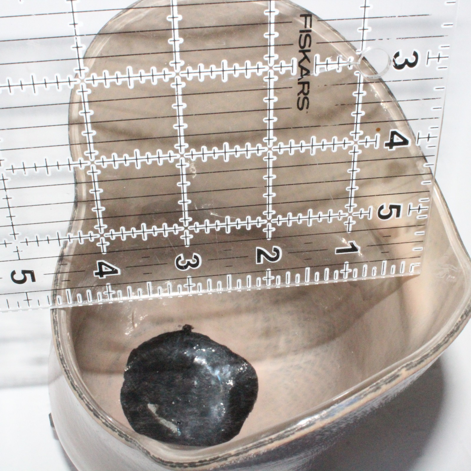 BELOW-KNEE PROSTHETIC SOCKET w/ EVOLUTION VMP-001 DISTAL BASE + VACUUM VALVE