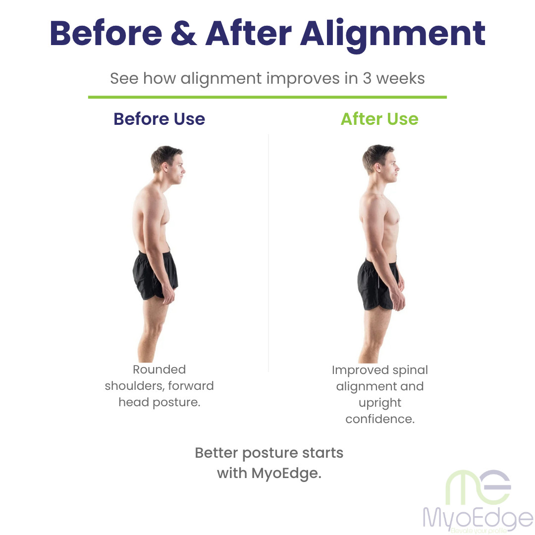 MyoEdge™ CoreCorrect Posture Brace – Back & Shoulder Posture Corrector Support