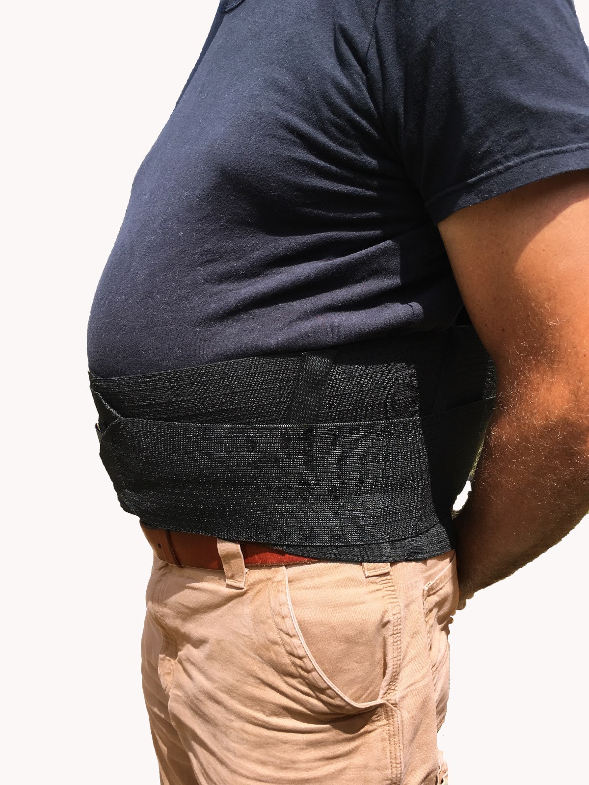 Alpha Medical Obesity Support Back and Belly Brace