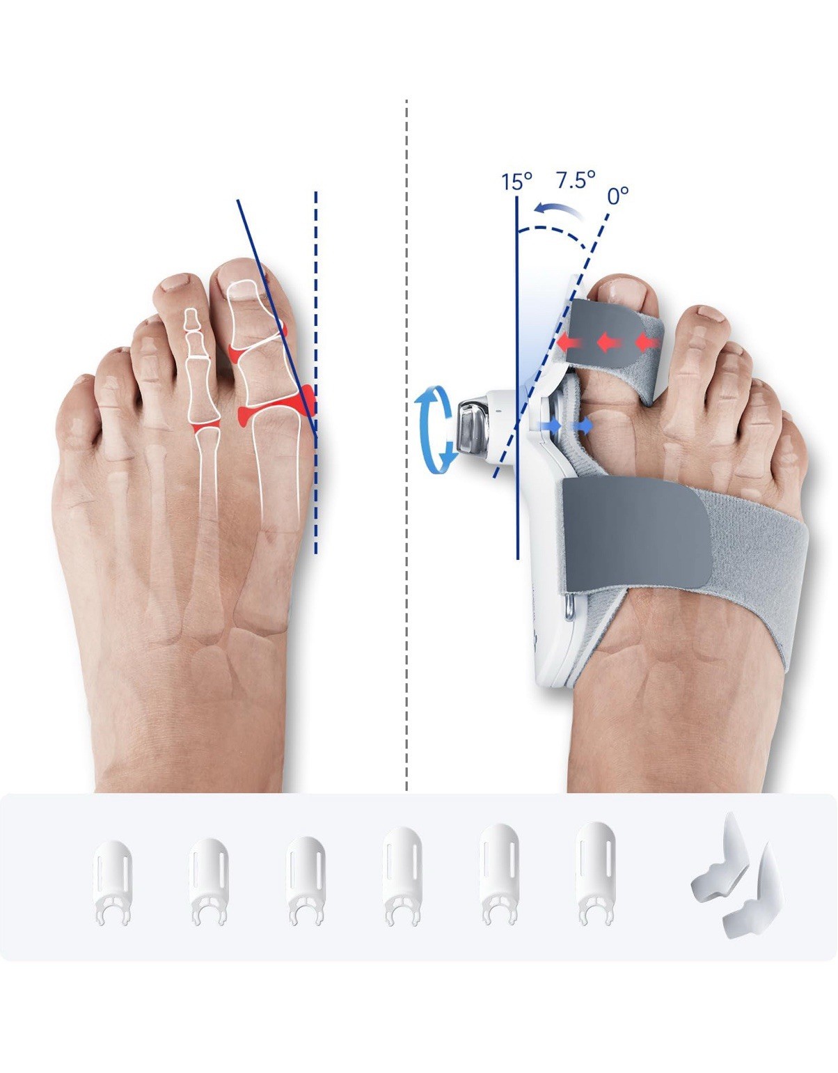 Bunion Corrector Splint for Big Toe – 3 Angle Plates, Hallux Valgus Relief