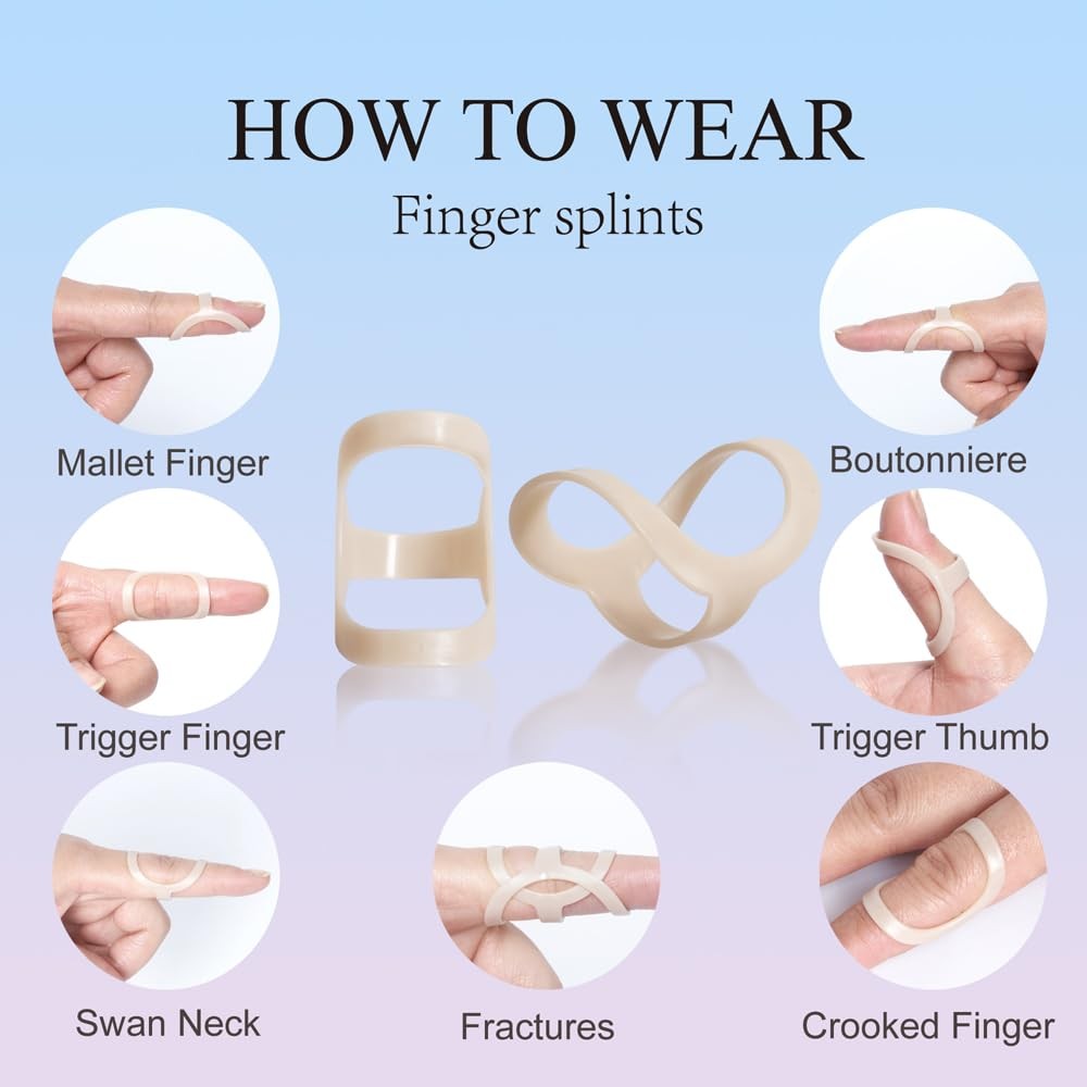 Oval Finger Splint 8 pcs, Finger Splints for Arthritis, Mallet Finger, Trigge…