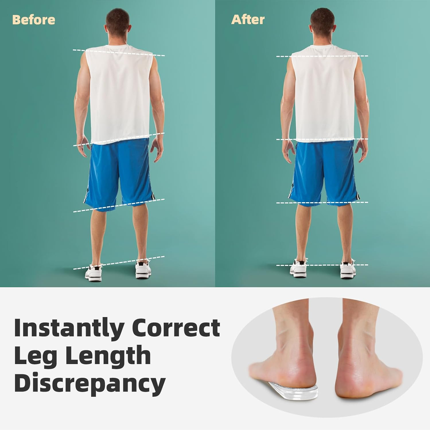 Heel Lifts, Shoe Lifts for Uneven Legs, 4 Layers Adjustable Orthopedic Heel Lift