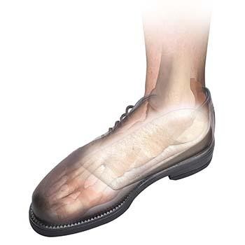 Hapad 3/4 Length Heel Wedges