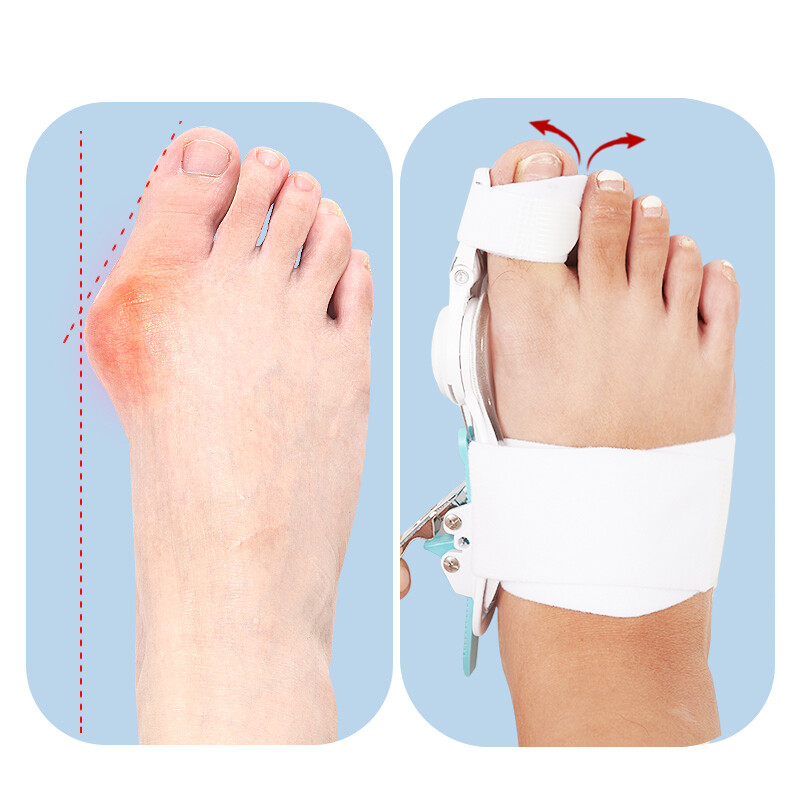 Bunion Splint Big Toe Straightener Corrector Knob Hallux Valgus Orthopedic Strap