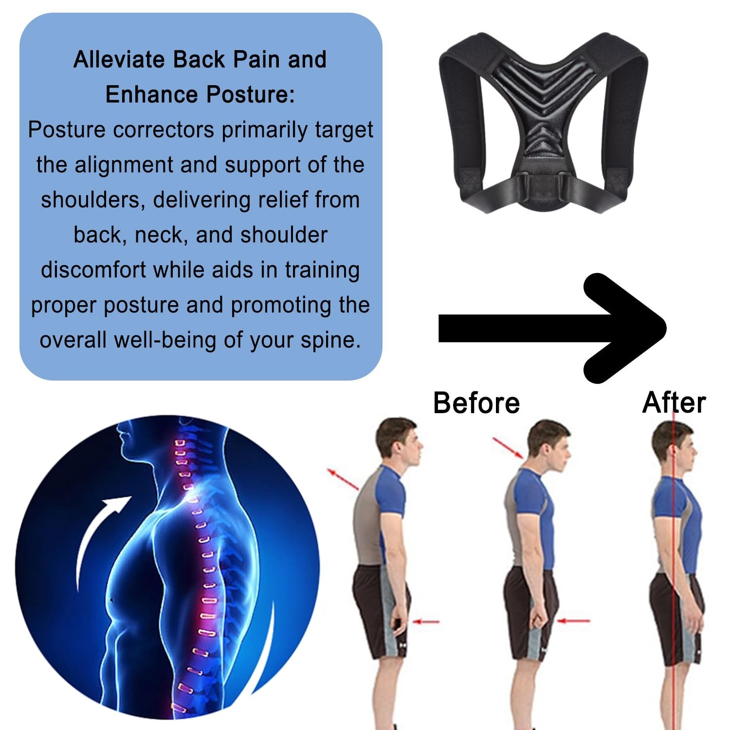 Posture Corrector, Back Brace for Women and Men, Adjustable Back Support, Sho…