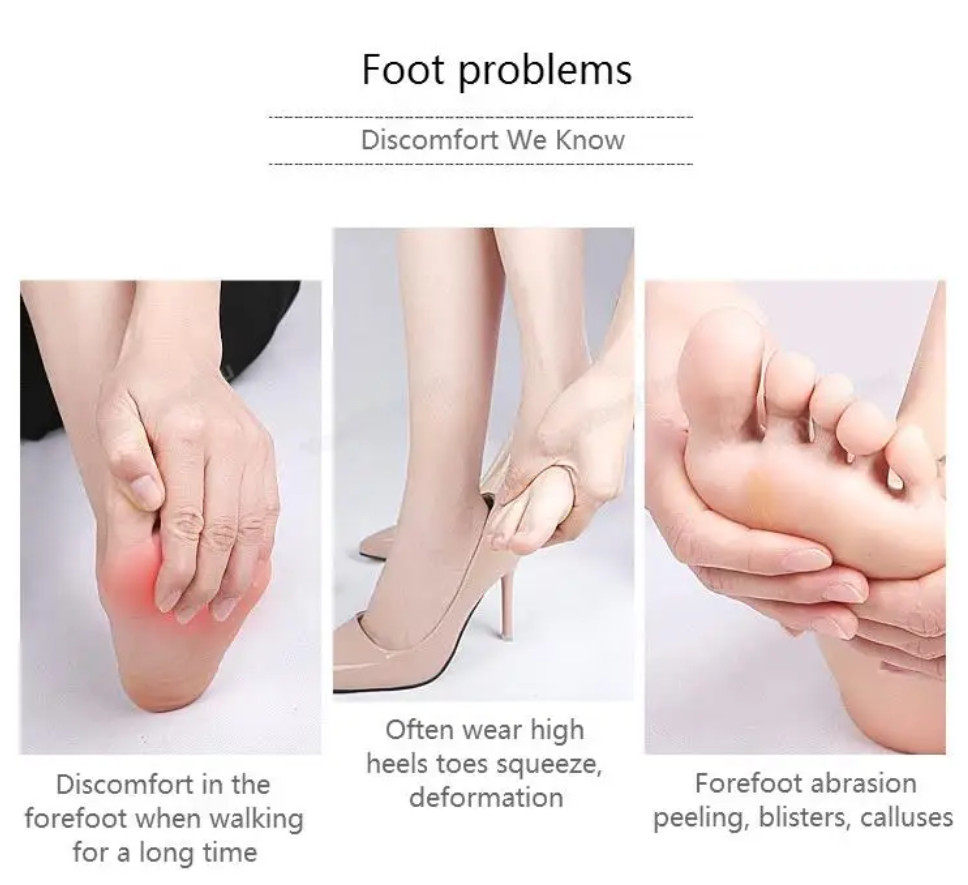 Briza Toe Sleeves