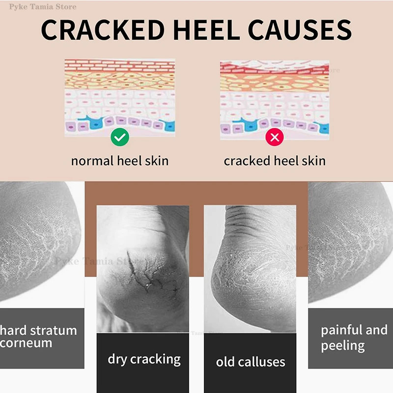 2pcs Heel Protective Cover Silicone Feet Care Anti-Crack Pain Relief Moisturizin