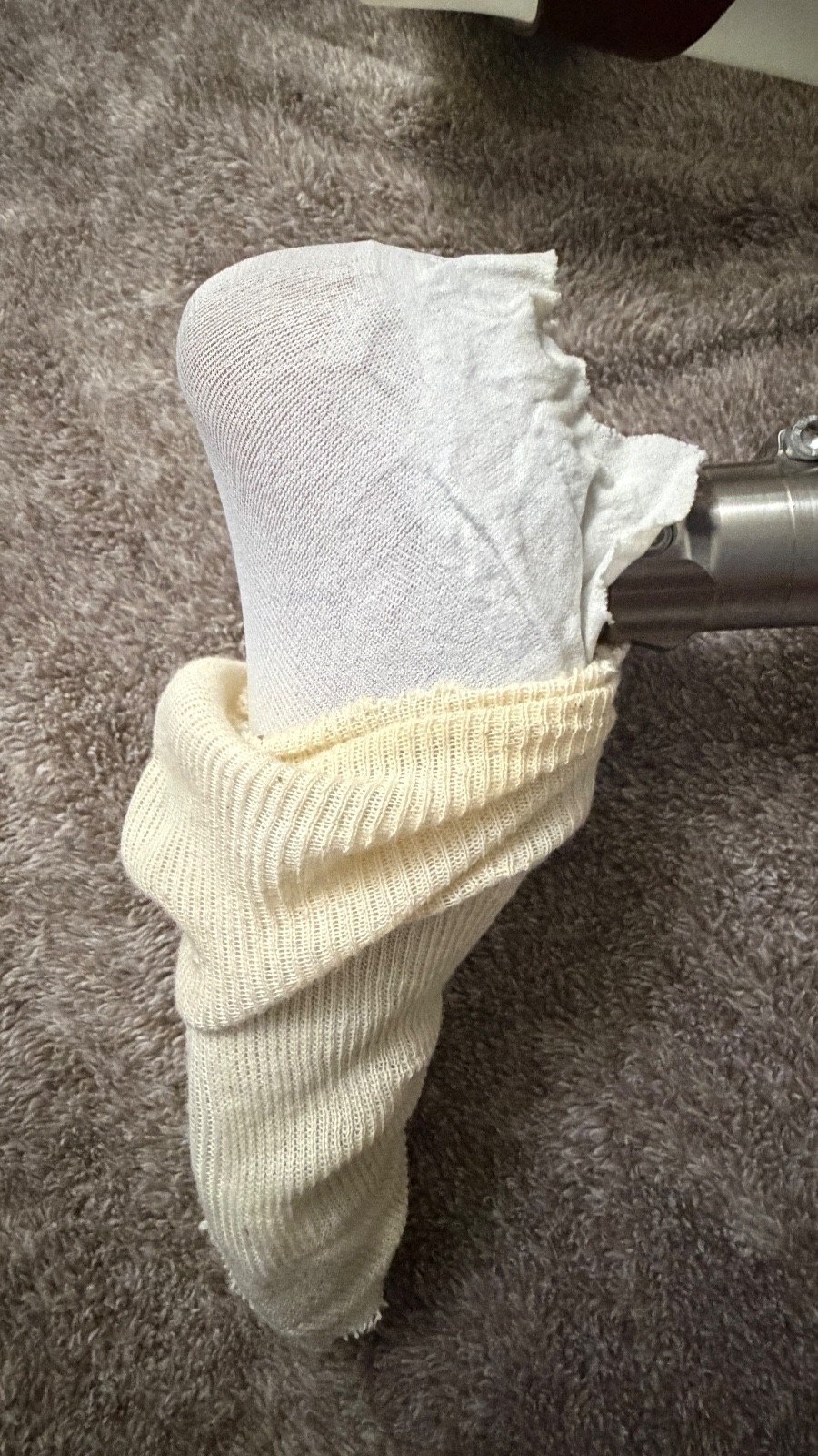 Vintage Ottobock Titan Left – Above the knee with Original Stub