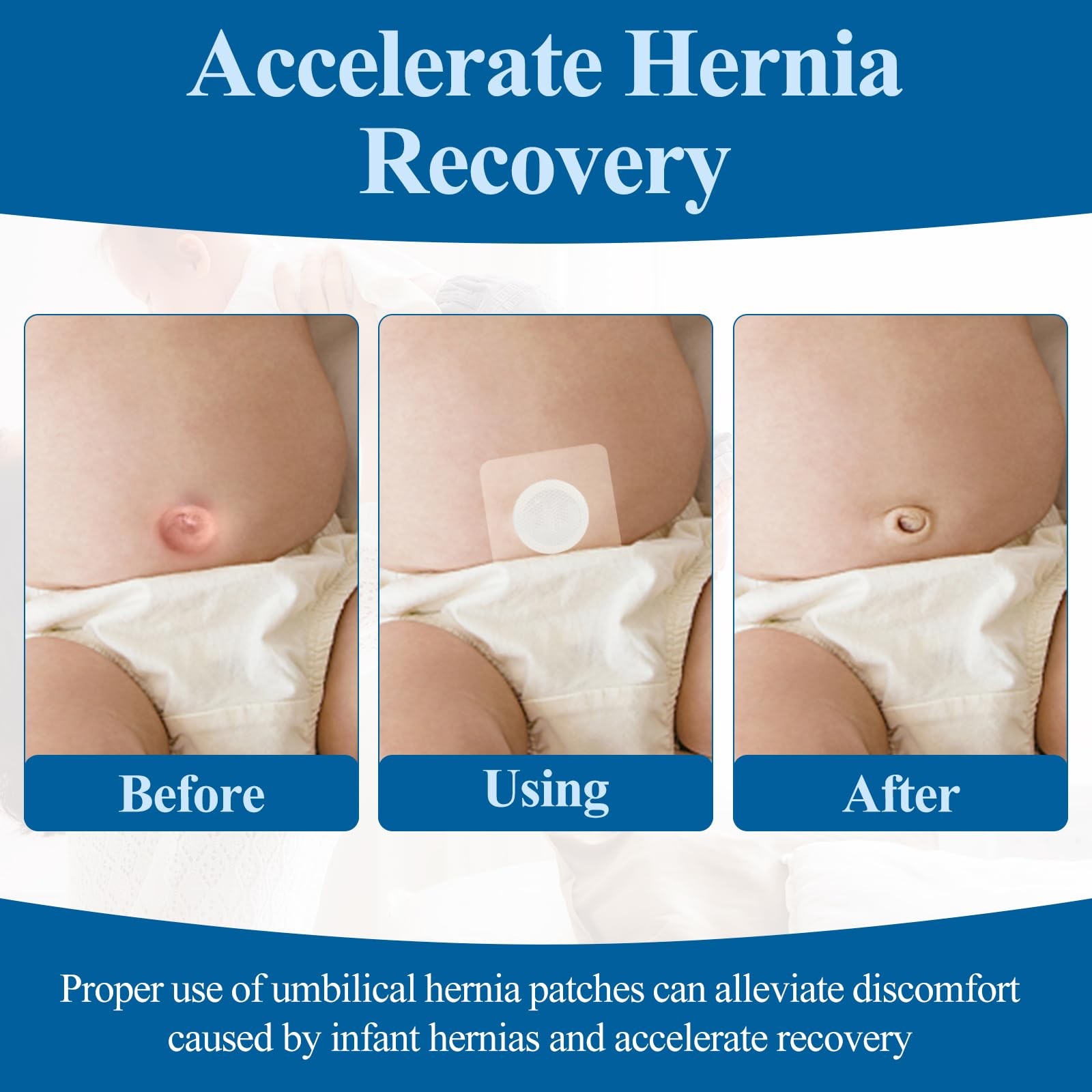 QCWN 35 Pcs Baby Belly Button Patches for Umbilical Hernia Waterproof Newborn…