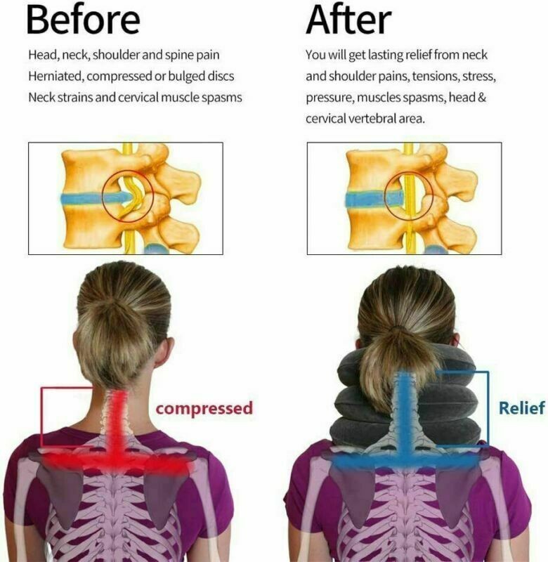 Cervical Neck Traction Device Collar Brace Support Pain Relife Stretcher Therapy