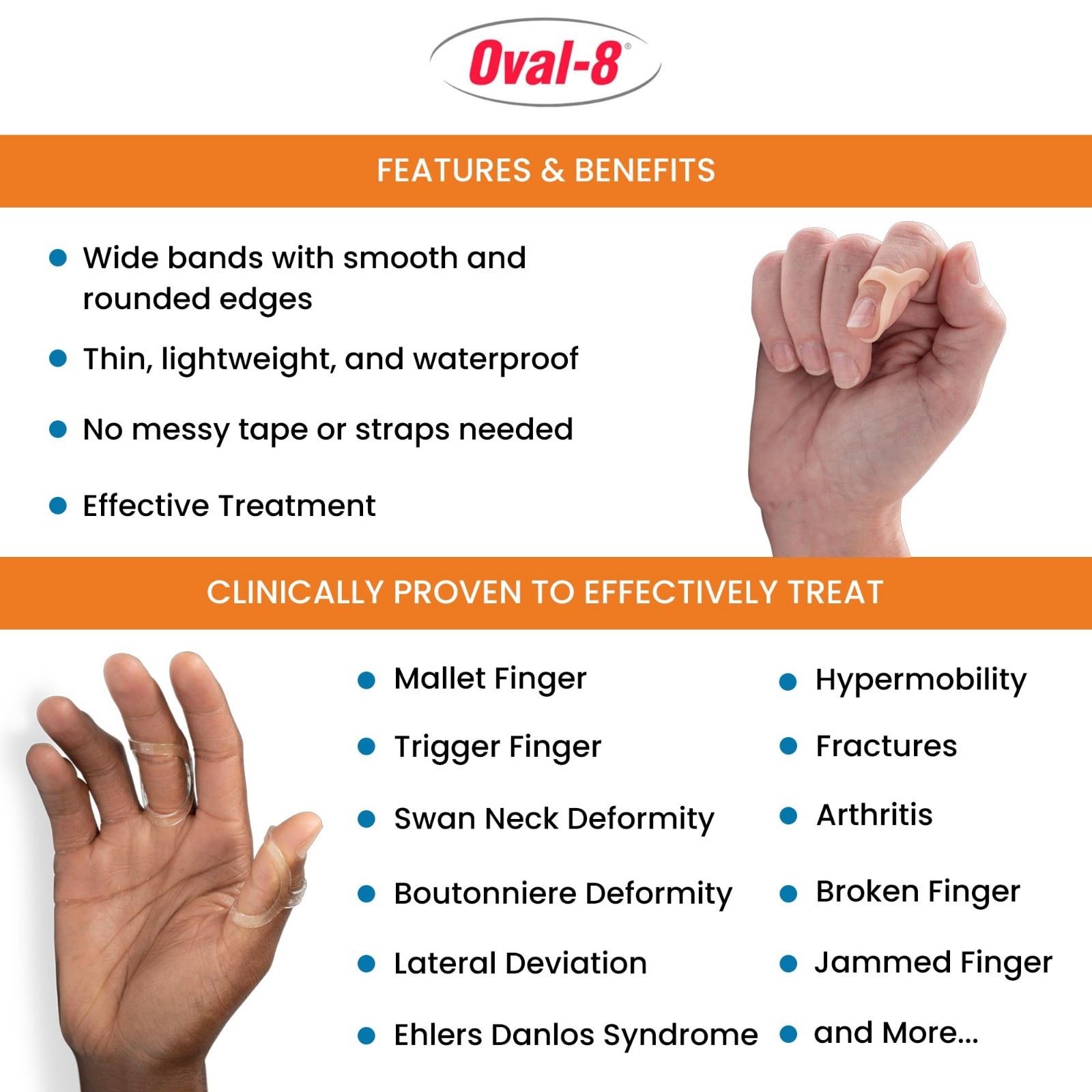 Multi-Size Oval Finger Splint Pack – Sizes 6, 7, 8 – 3-Point Support