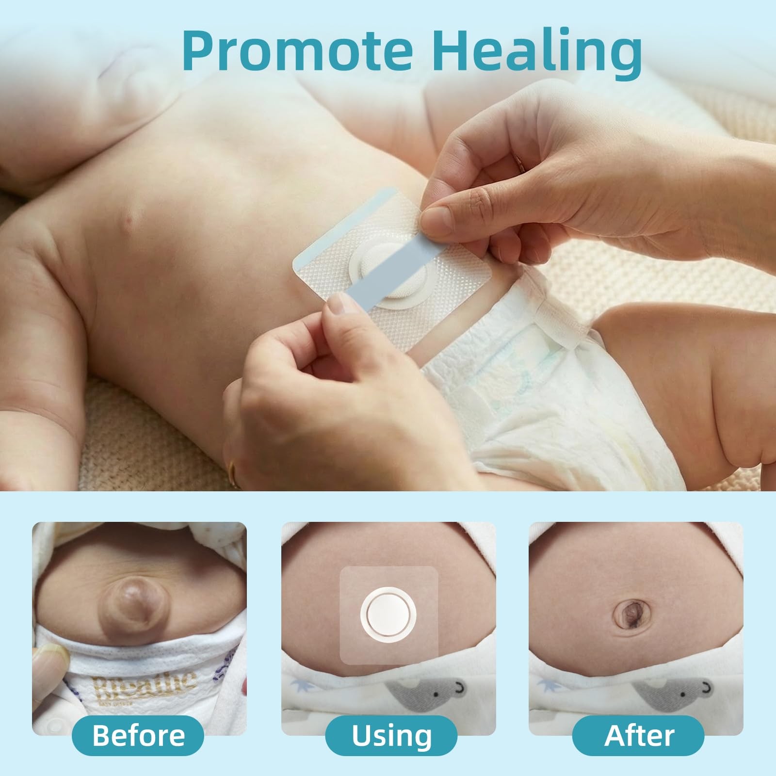 Baby Belly Button Patches, Infant Umbilical Hernia Belt Band Shaper, 10 Pcs |…