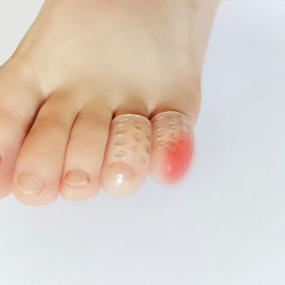 Silicone Toe Caps Anti-Friction Breathable Toe Protector Prevents Blisters JQ
