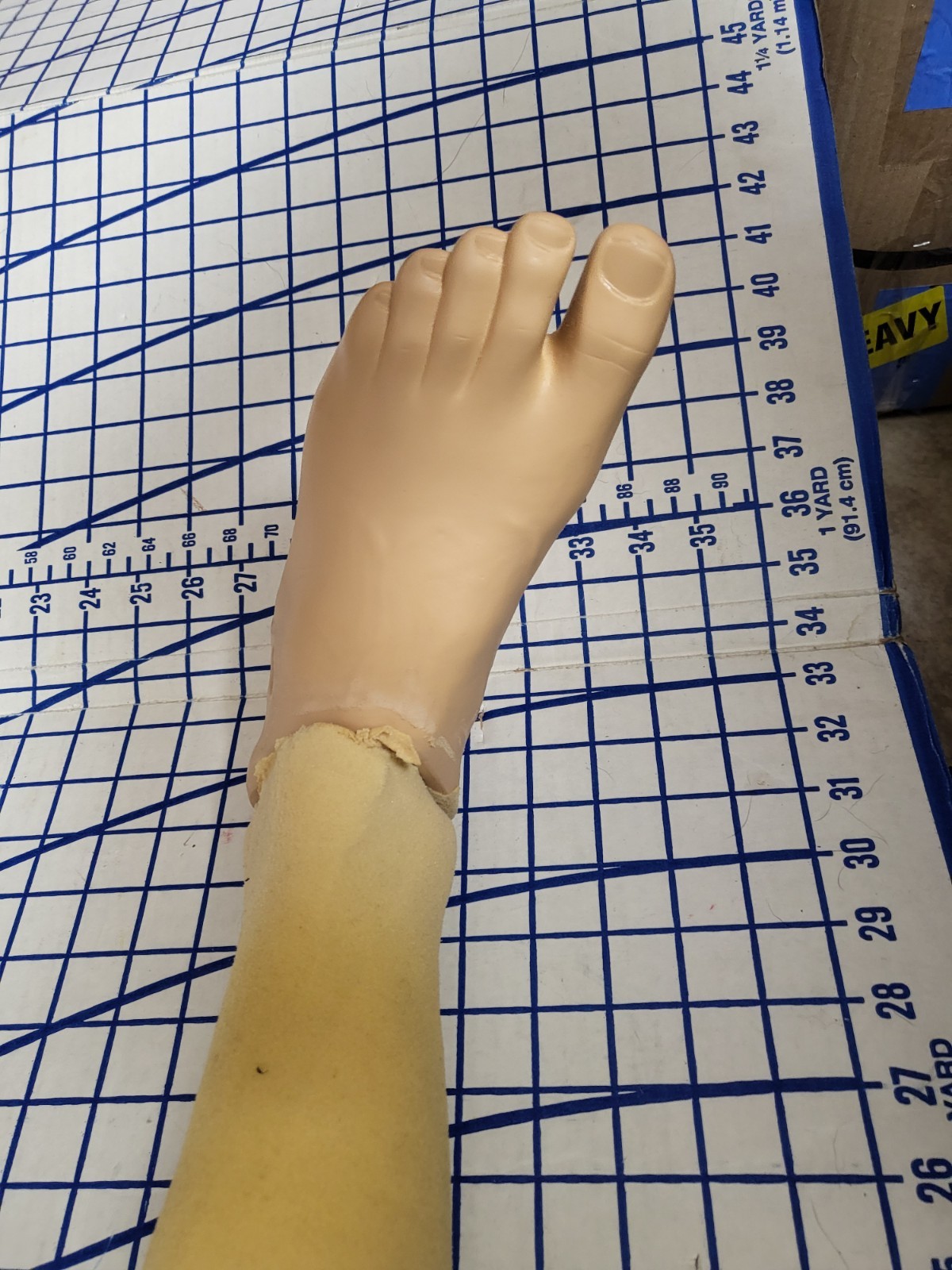 Complete Prosthetic Left Leg Knee WillowWood Limblogic Trulife Adult Dallas Cowb