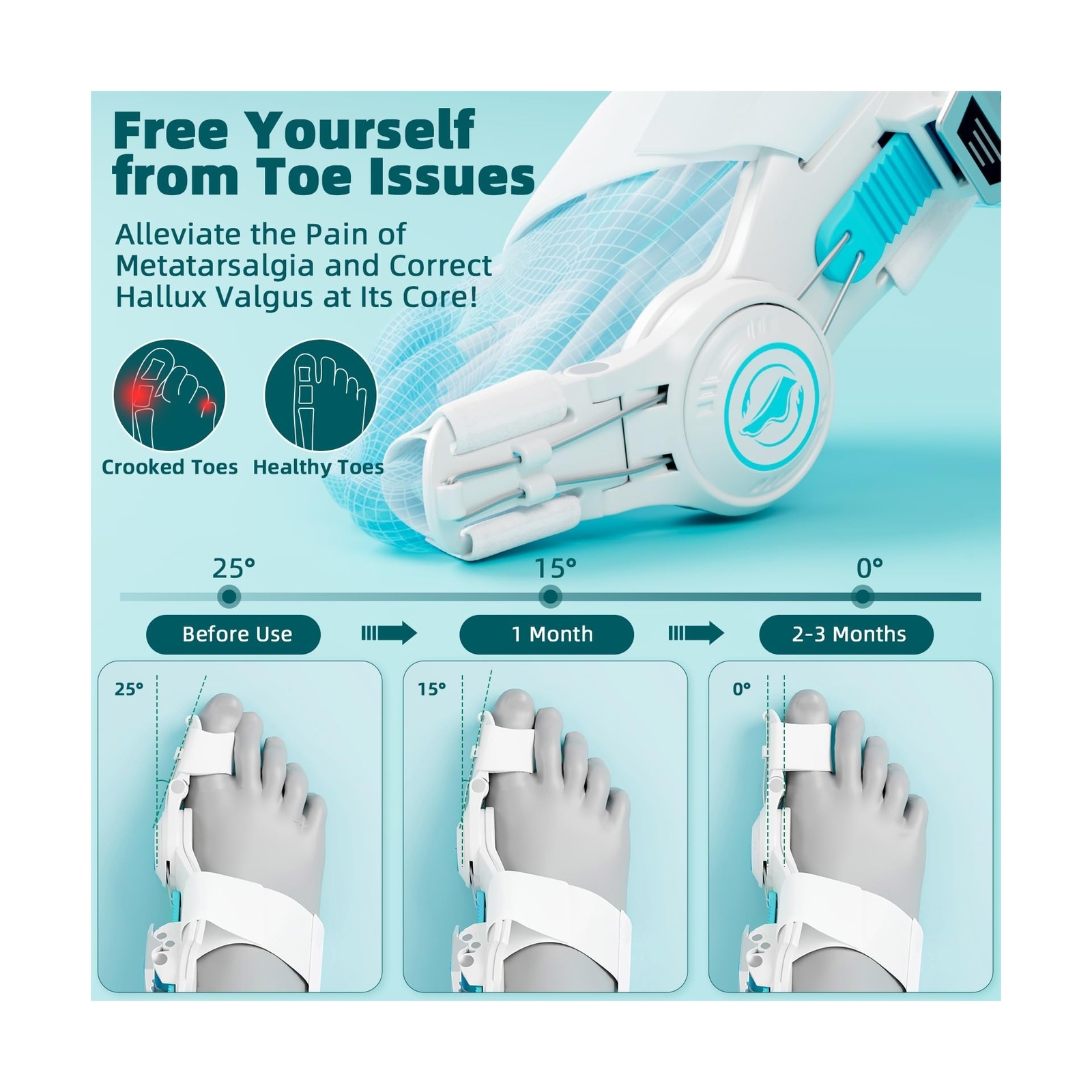 Upgraded Bunion Corrector for Women & Men, Orthopedic Bunions Correction with…