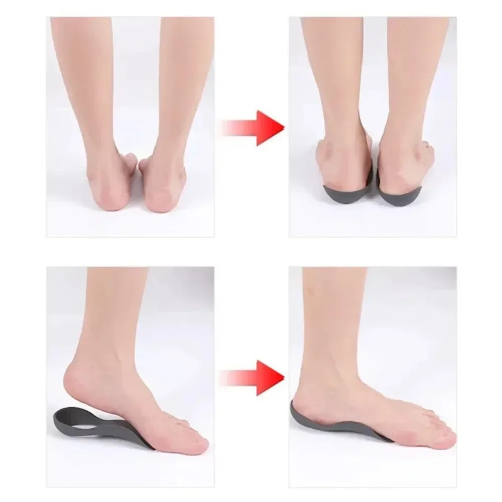 1 Pair Orthotic Insoles For Flat Feet O-Shaped Legs And Plantar Fasciitis – Unis
