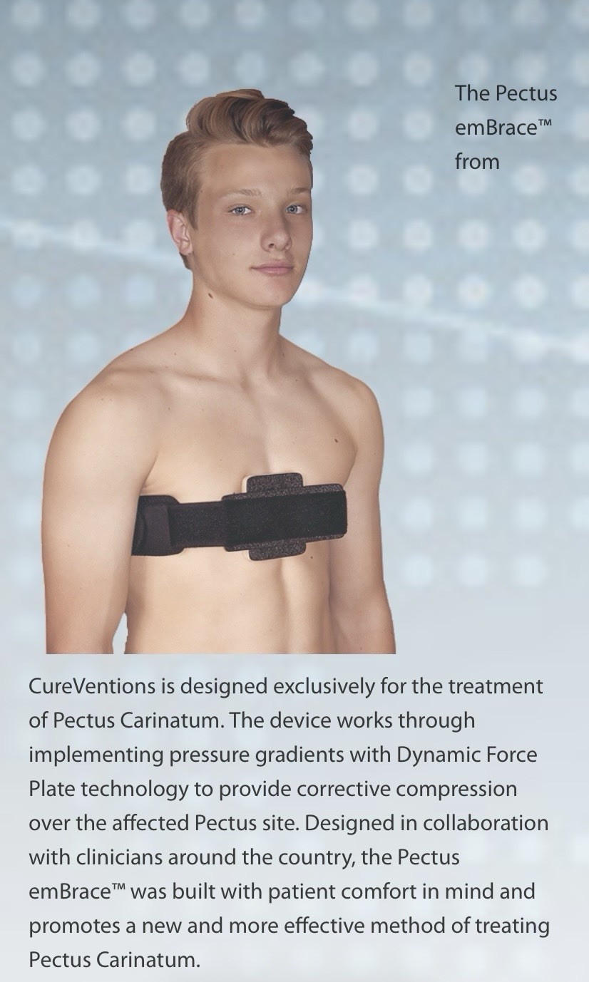 CureVention Pectus emBrace Chest/Torso Brace Medium Black Adjustable PEBRMD