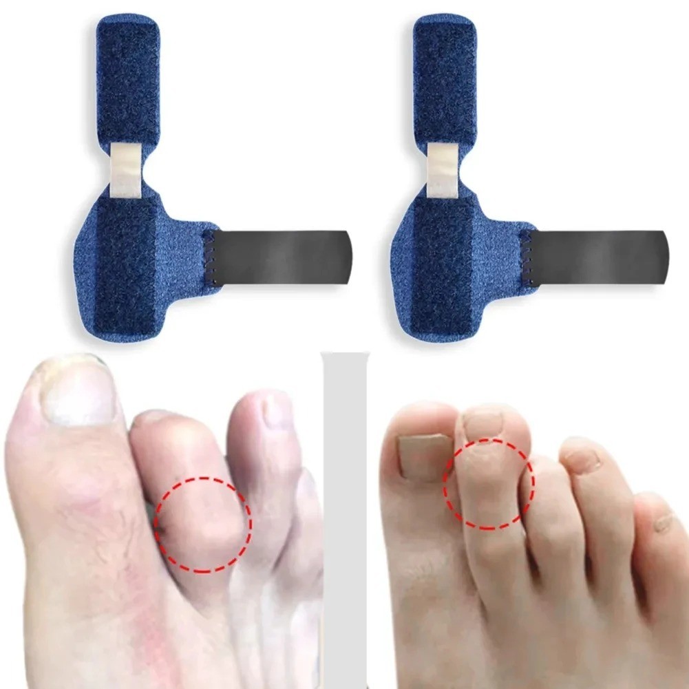 Toe Straightener Hammer Toe Corrector Brace Splint Wrap for Broken Fingers Toes