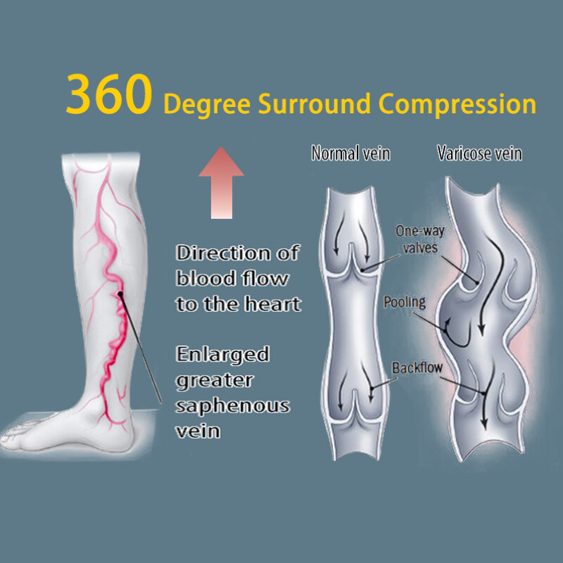 Women Mens Knee High Compression Socks 20-30mmHG Stockings Support Brace Sports