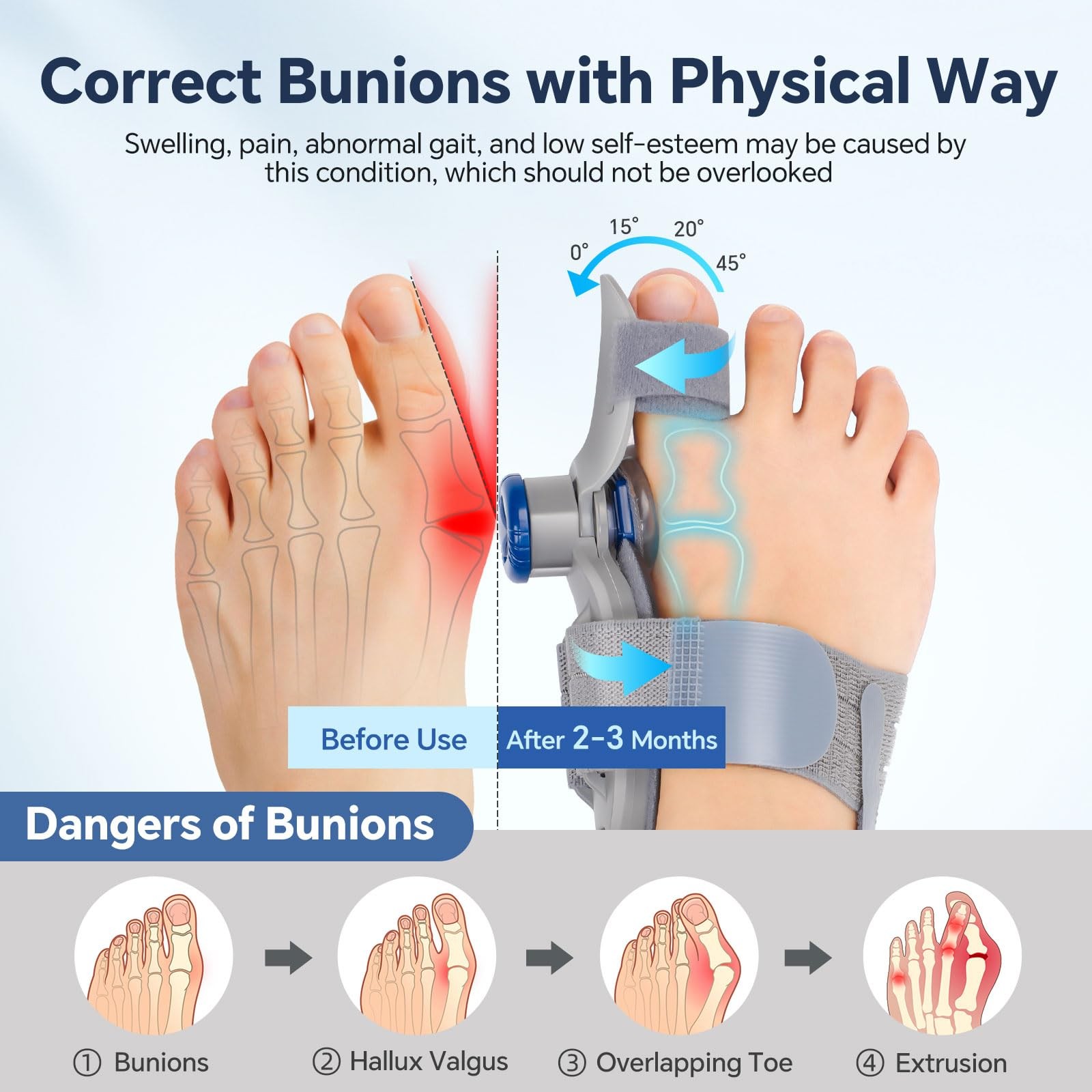 ROHVEMJ Bunion Corrector for Women Men, Big Toe Straightener with One Size