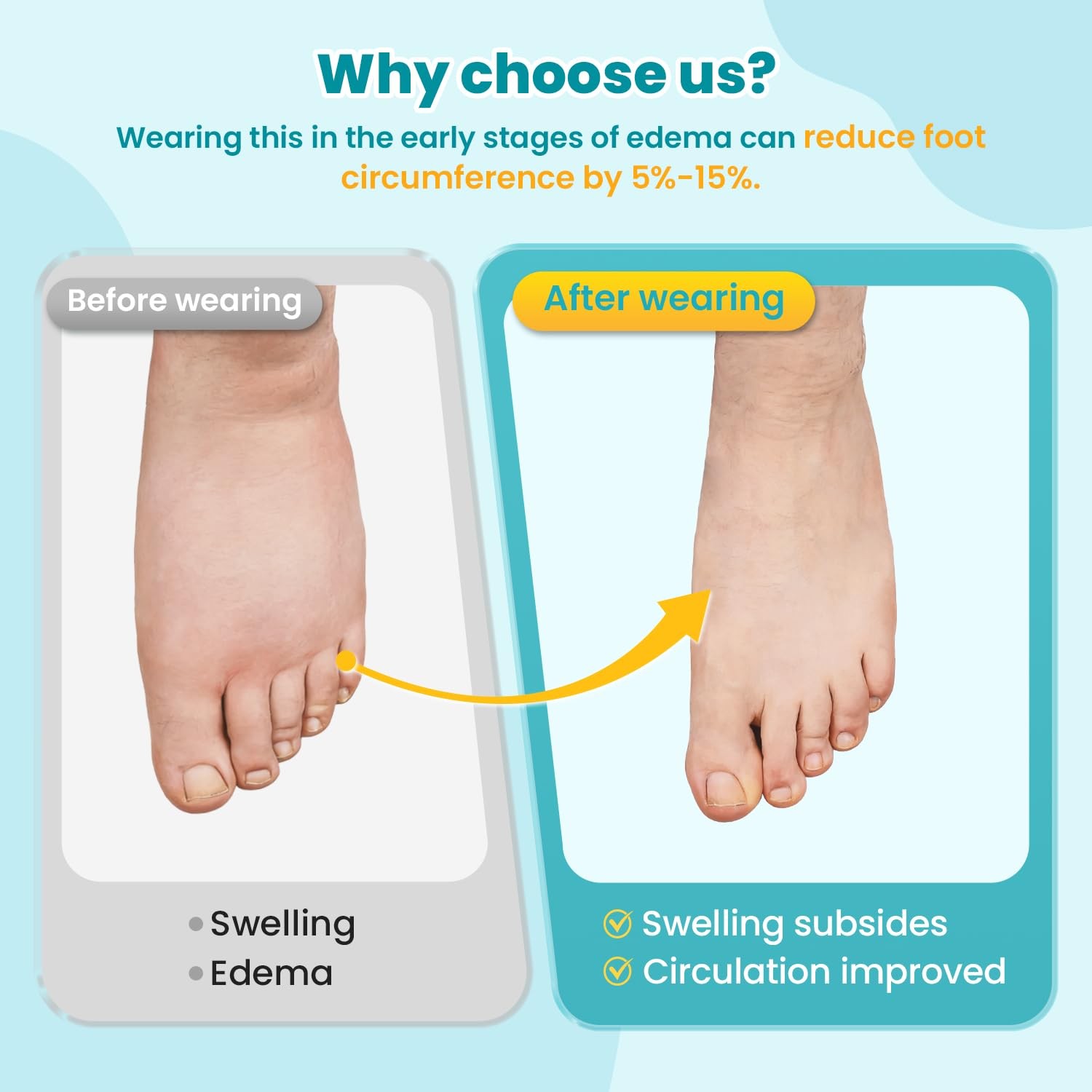 ® Swollen Foot & Ankle Edema Compression Wrap Brace Adjustable Sleeve for Foo…
