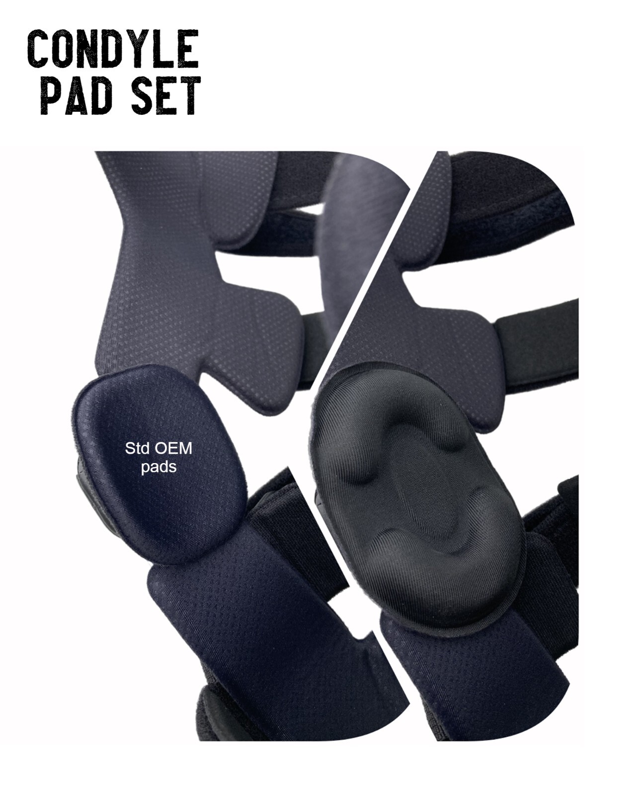 Knee Brace Parts – Condyle Pad Set – DonJoy, Ossur, CTi, Breg, Medi, Thuasne