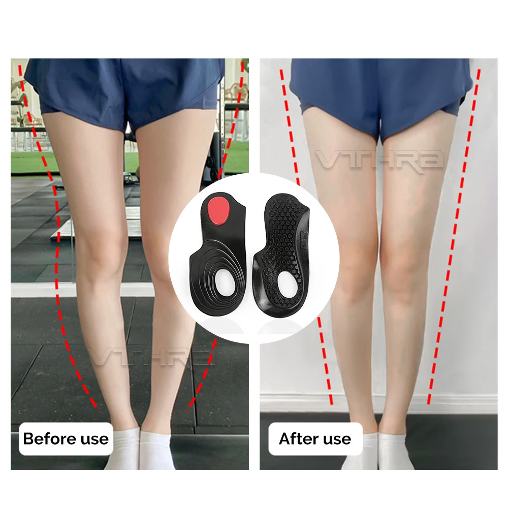 OX Leg Orthotics Cubitus Varus half flat foot Insole Orthopedic Insoles for Shoe