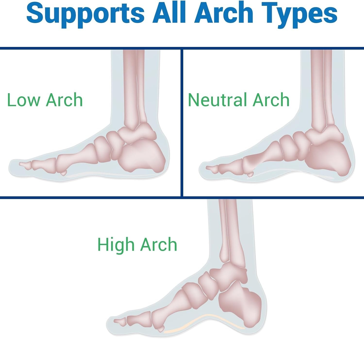 Plantar Fasciitis Support Insoles for Women & Men – Customizable 3/4 Arch Design