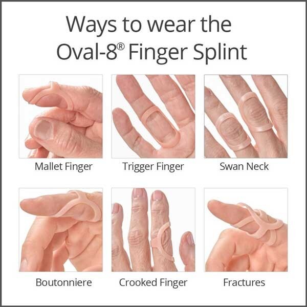 3pp Oval-8 Finger Splint – Combo Package (10/11/12/13/14)