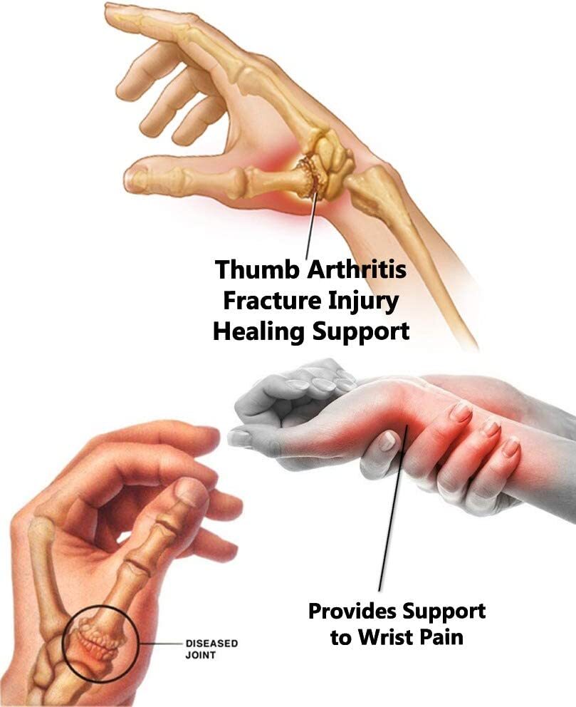 Thumb Spica Splint Brace Support Right Left Hand Carpal Tunnel Pulgar Pulsera
