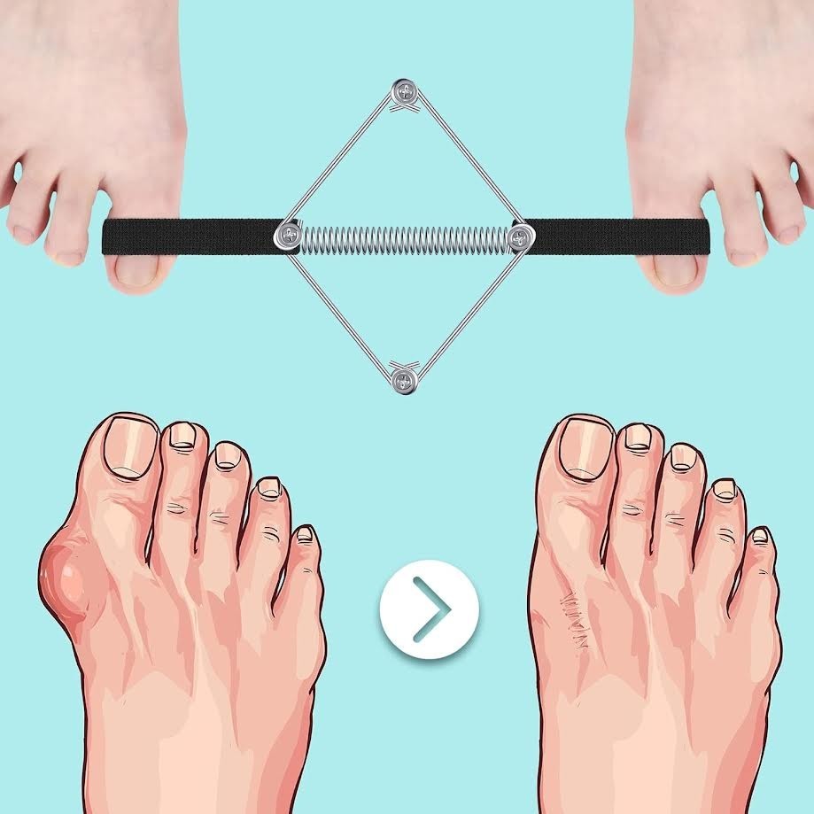 Pilates Method Bunion Corrector Toe Straightener Exerciser Foot Pain Relief