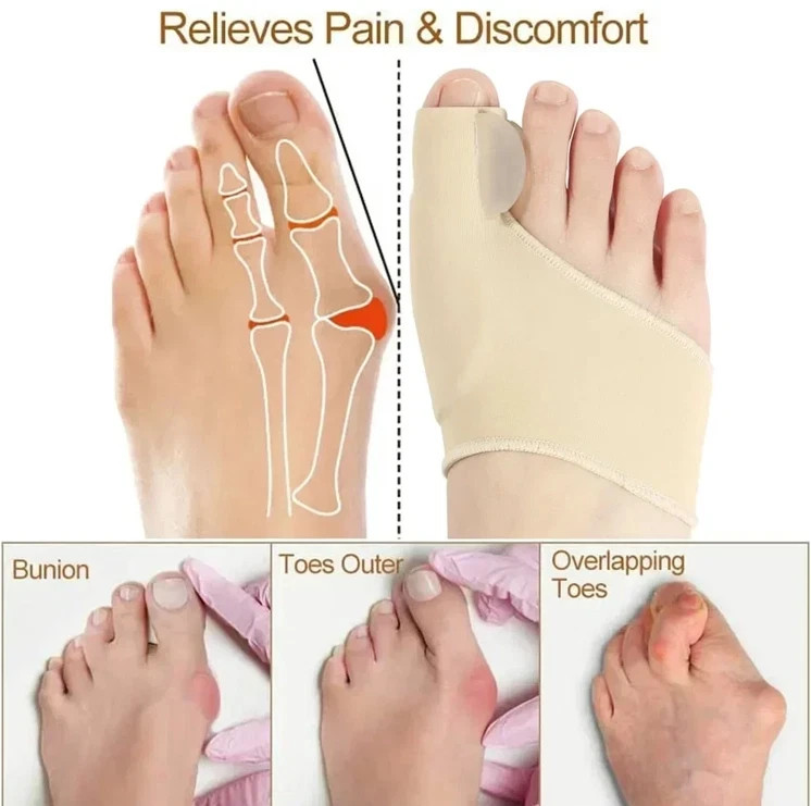 Recovist Bunion Corrector, Recovist Bunion Brace, Big Toe Straightener Bunions