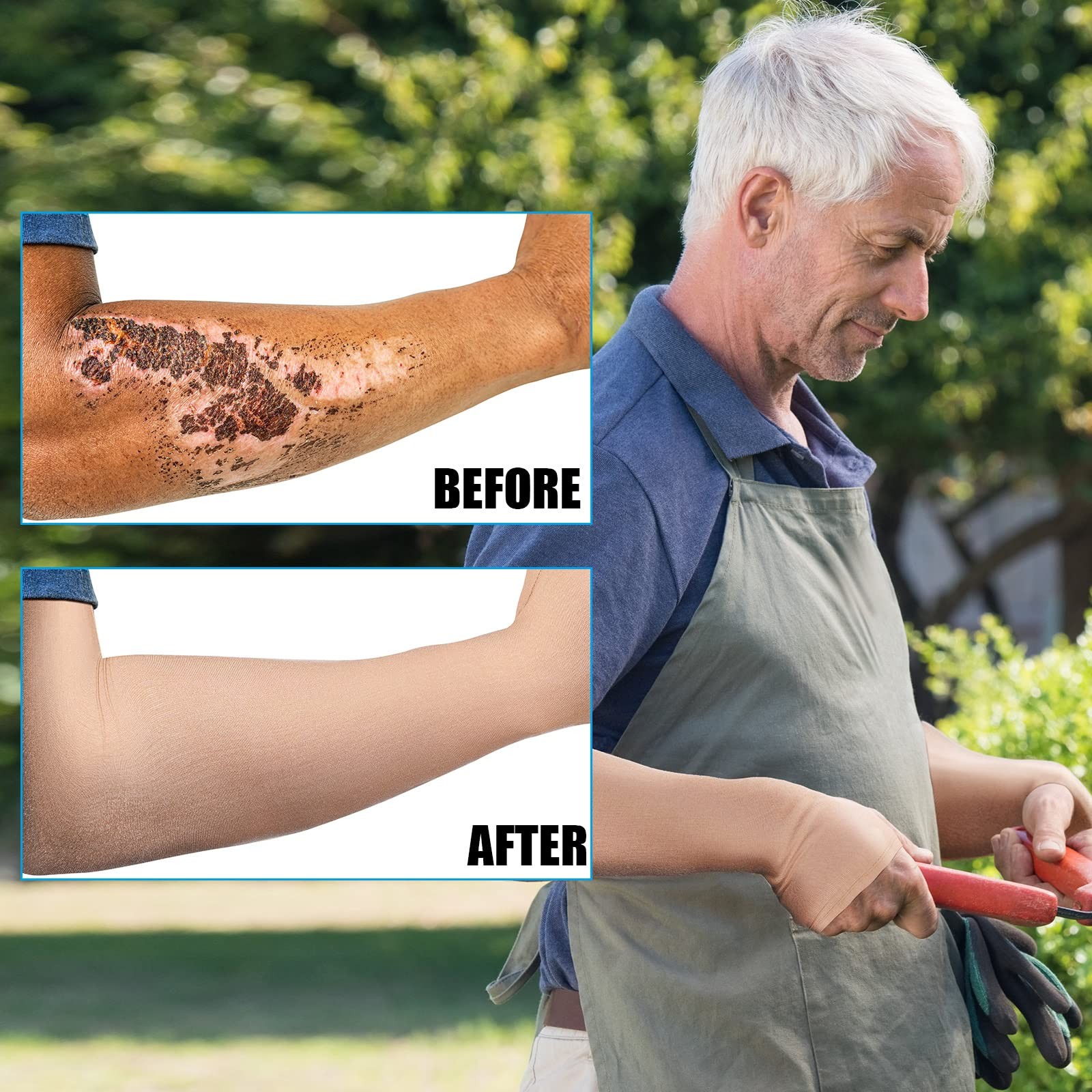 Coume 2 Pairs Elderly Skin Protection Sleeves Arm Medium, Elegant Style