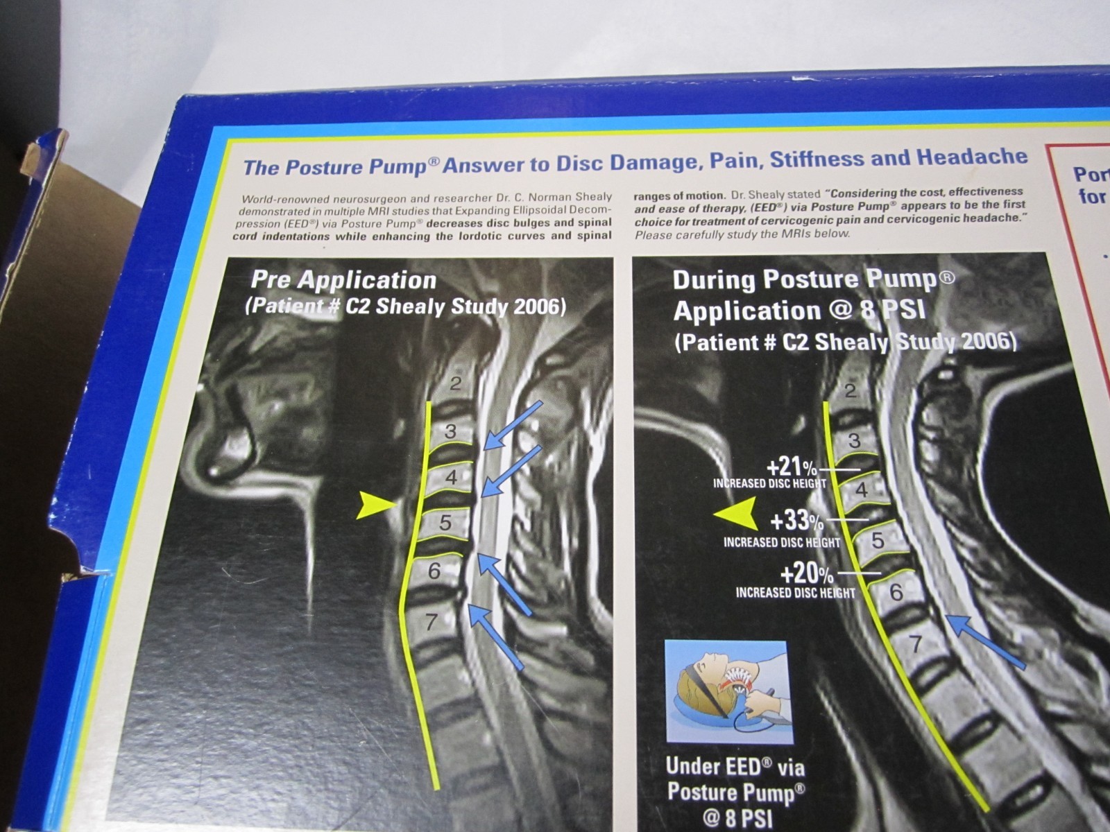 Posture Pump Neck Exerciser – Disc Hydrator – Model 1000