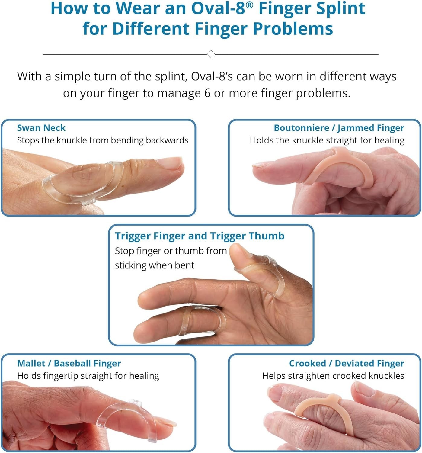Oval-8 Finger Splint Pack – Sizes 4, 5, 6`