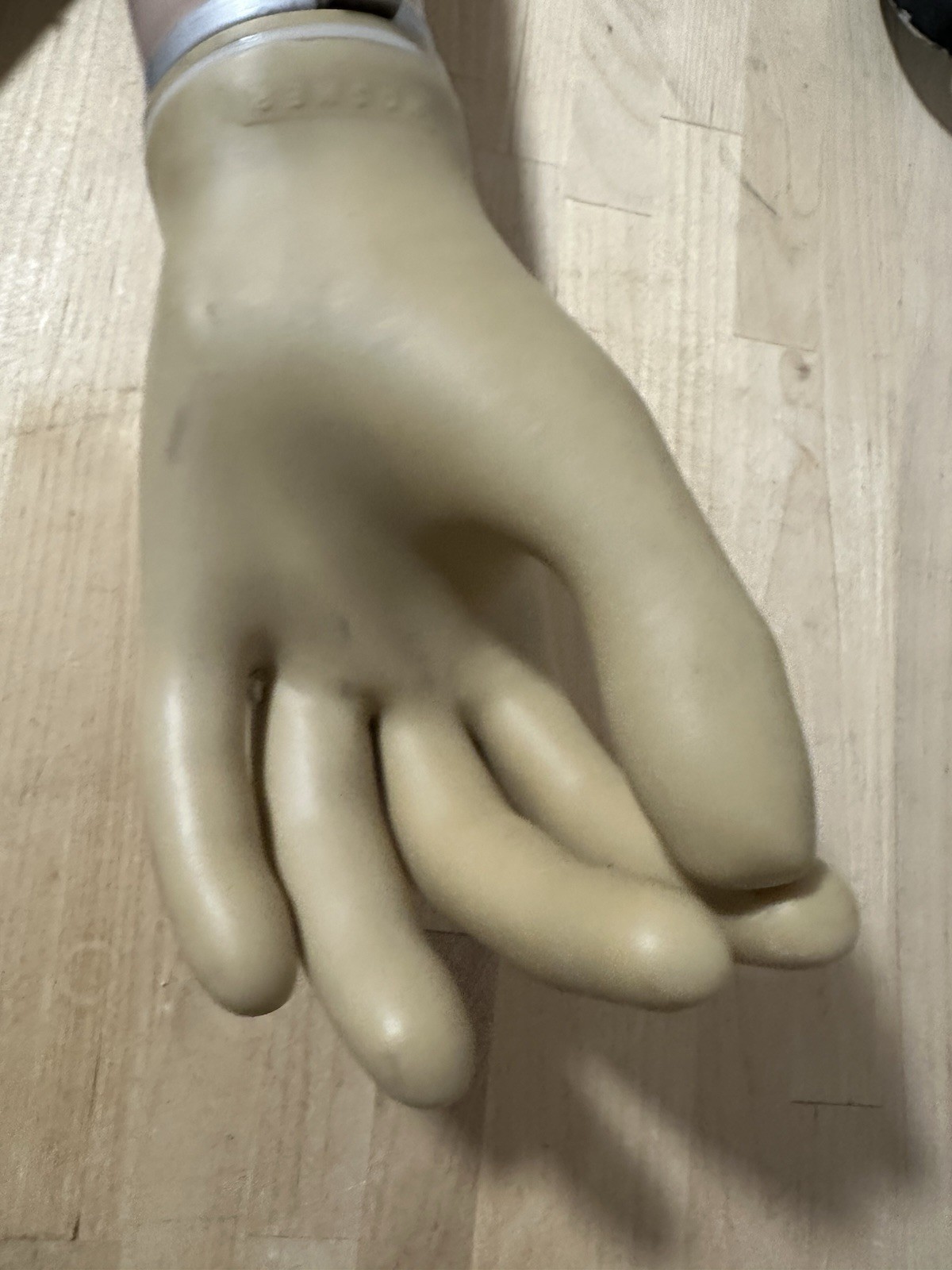 Hosmer Electronic Prosthetic Arm