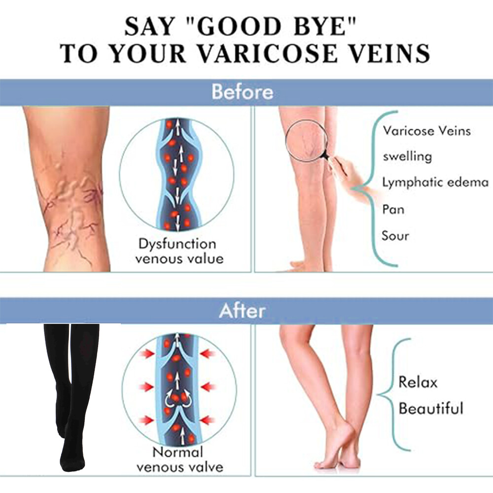 Tight Stocking Gradient Compression Support Pantyhose for Varicose Veins US