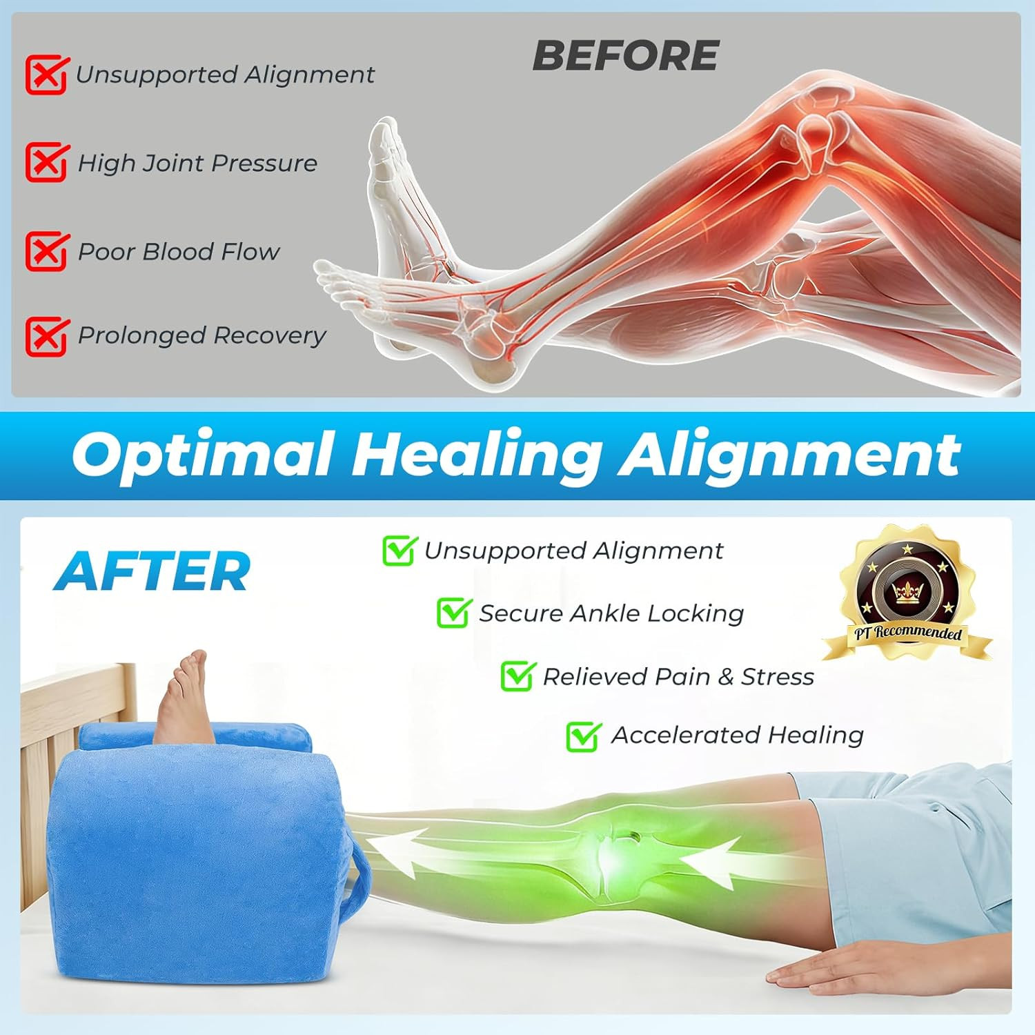 Post-Surgery Knee Replacement Pillow – Memory Foam Leg Elevation Support
