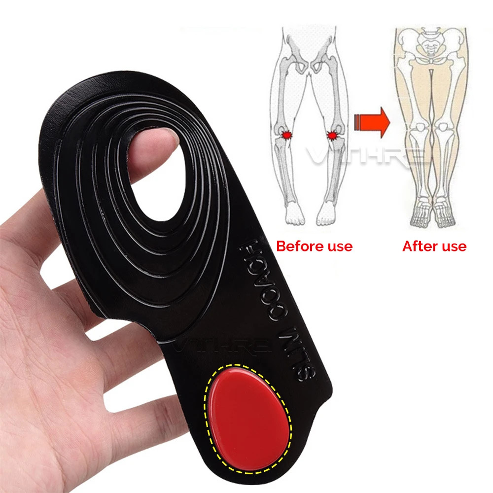 OX Leg Orthotics Cubitus Varus half flat foot Insole Orthopedic Insoles for Shoe