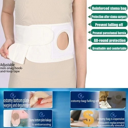 Flosmore Ostomy Support Belt，Adjustable Prevent Parastomal Hernia Support Bel…