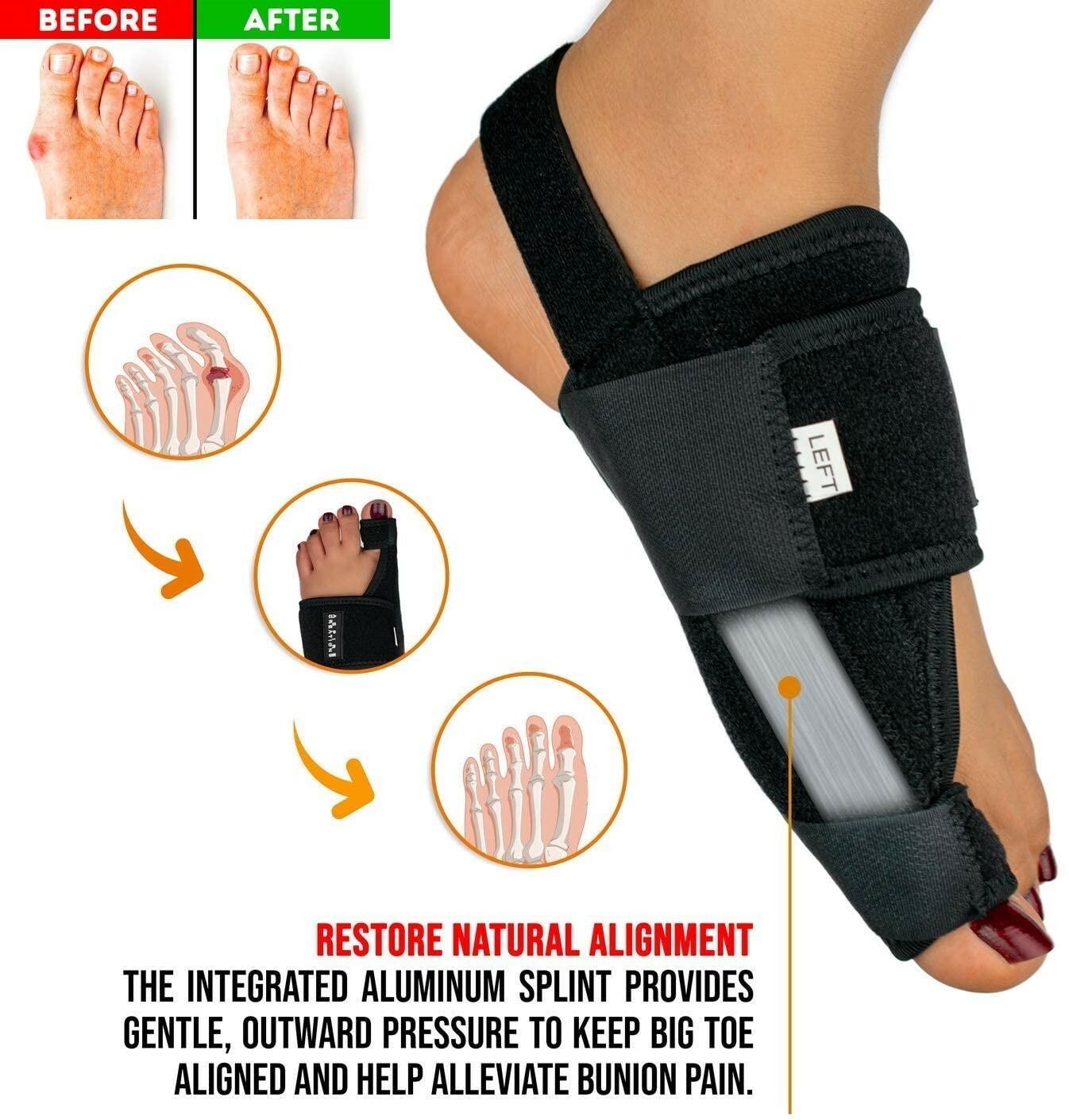 Bunion Corrector Splint w/ Memory Foam + Silicone Big Toe Separators (4 Piece)