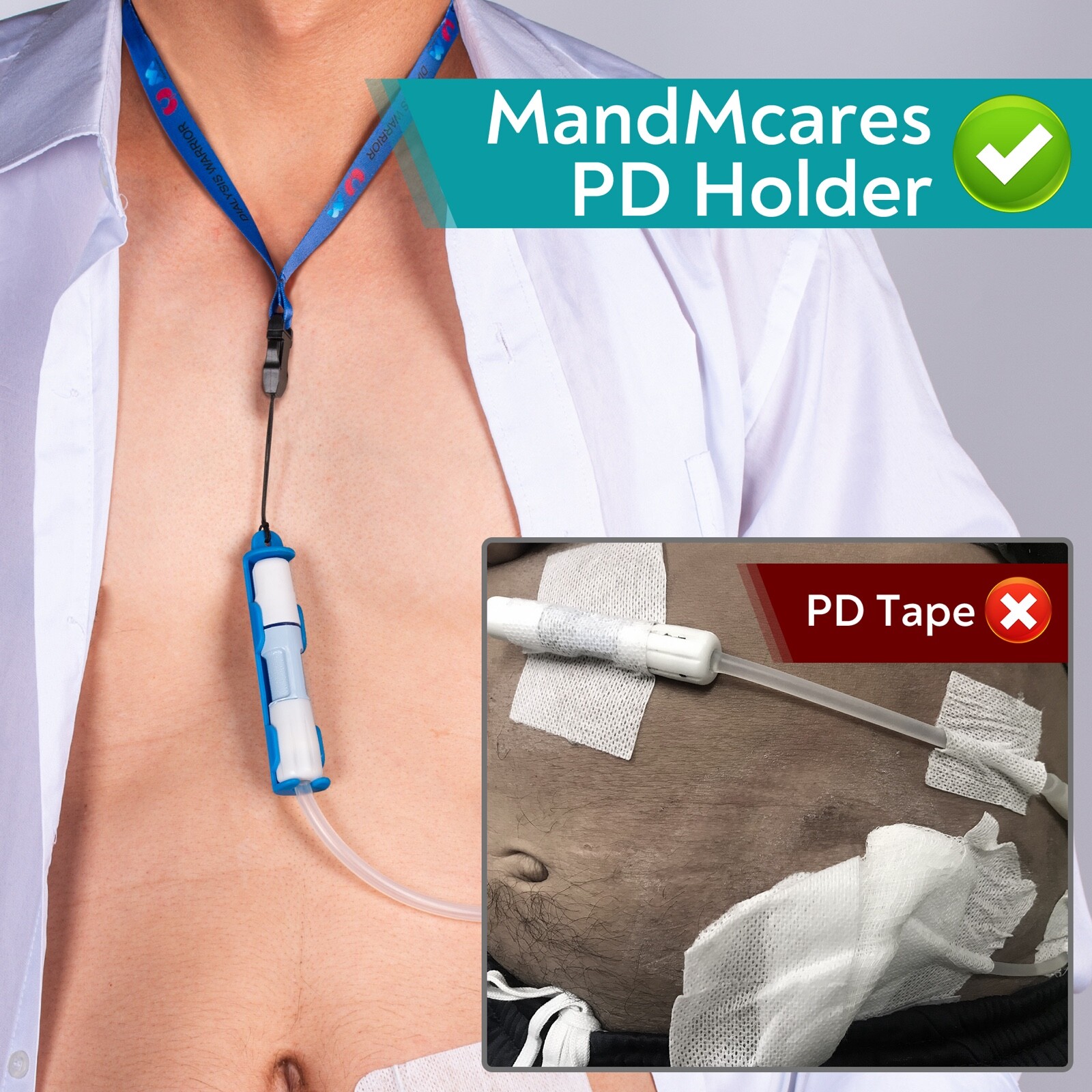 Peritoneal Dialysis Transfer Set Holder for Baxter 2 Lanyard PD Belt Accessories