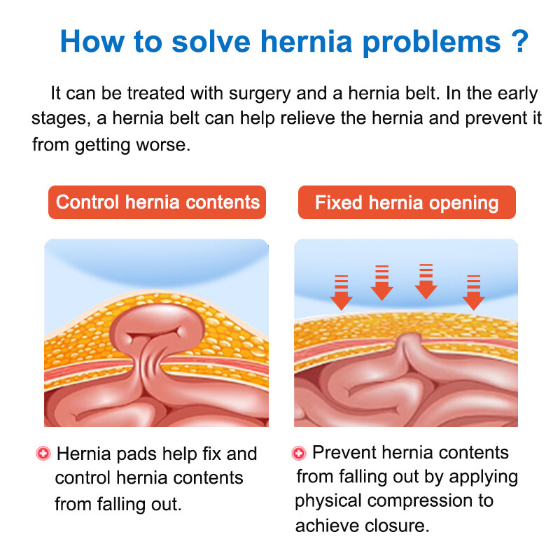 Mens Inguinal Groin Hernia Support Belt Hernia Pain Relief Truss Brace & 4 Pads