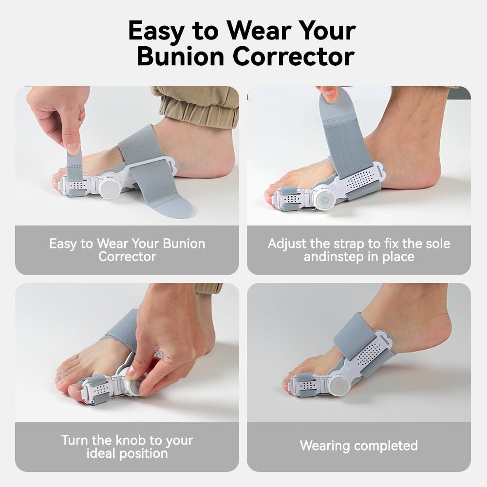 New Upgrade Treatmedy Bunion Corrector for Women & Men, Adjustable Bunion Fix Sp