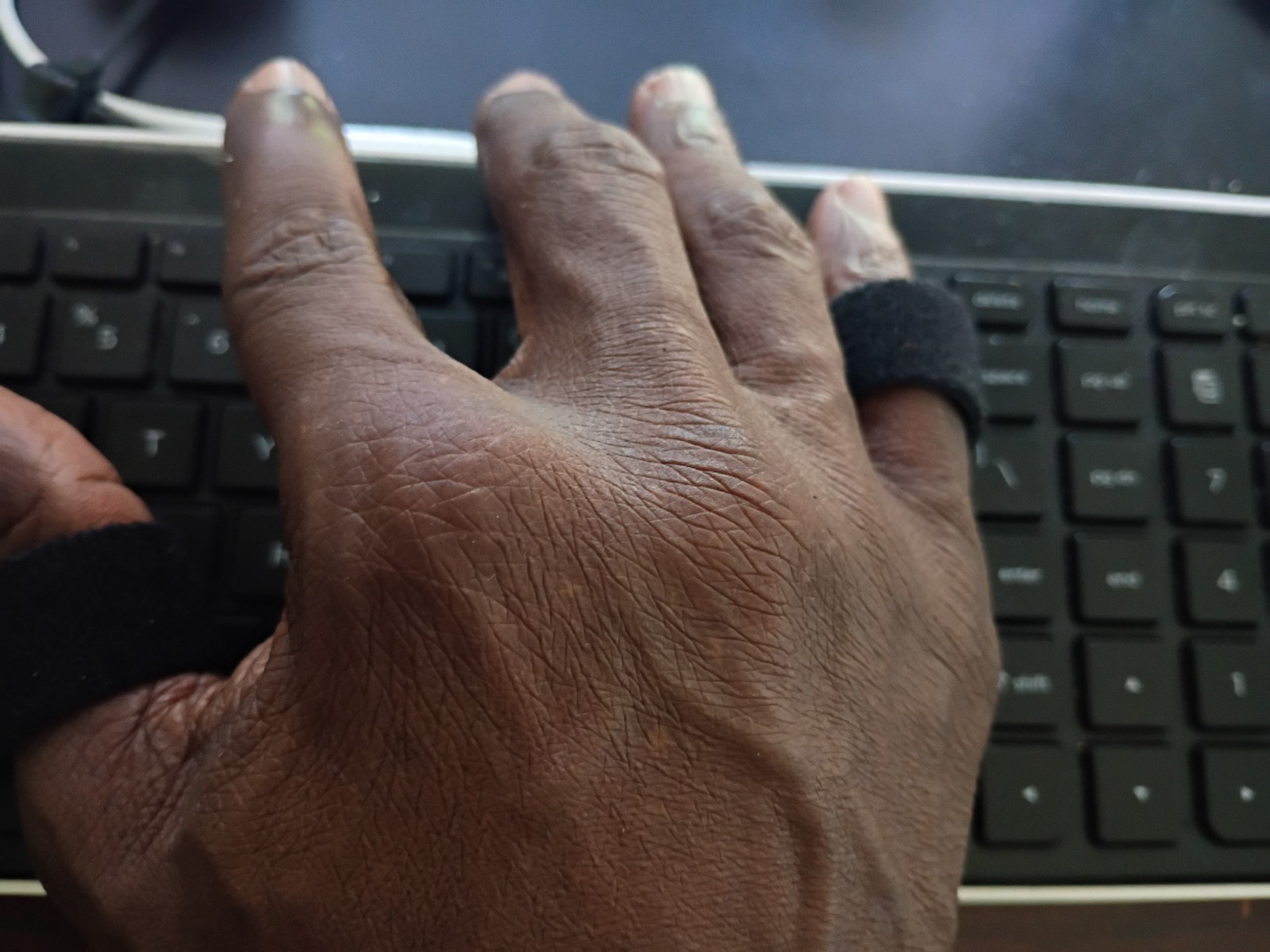 Thumb Support & Fingers Splint For Men and Women At Work and Home