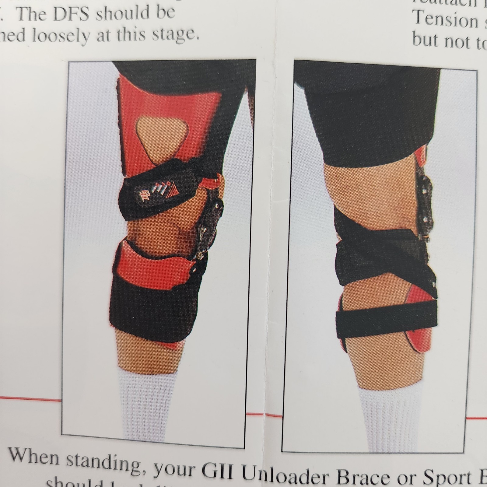 Ossur Unloader G2 II ADJ Right Knee Brace Custom XL-2XL