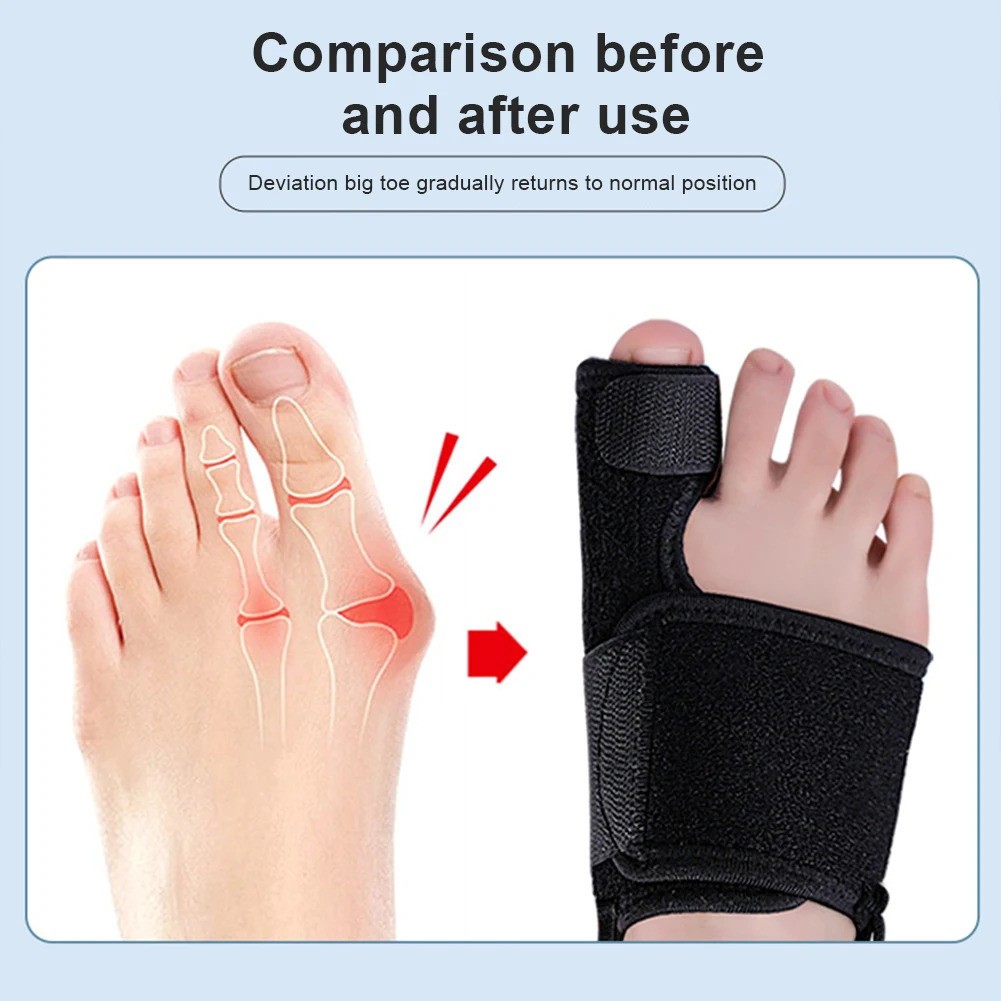 2PCS Bunion Corrector Big Toe Splint Straightener Hallux Valgus Left Right Foot